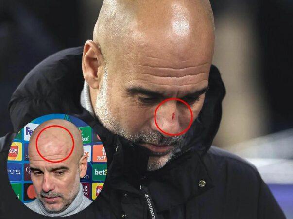 U shfaq i gjakosur pas Feyenoord, shokon Guardiola: Doja t’i bëja keq vetes