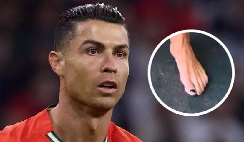 Pse Cristiano Ronaldo i lyen thonjtë e gishtave të këmbës? Pse Cristiano Ronaldo i lyen thonjtë e gishtave të këmbës?