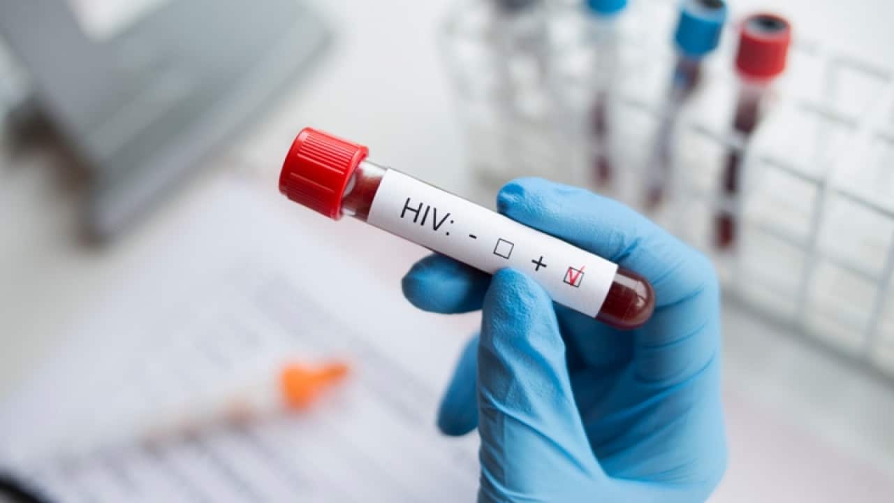 HIV në rritje: 10 raste të reja në pesë muaj HIV në rritje: 10 raste të reja në pesë muaj